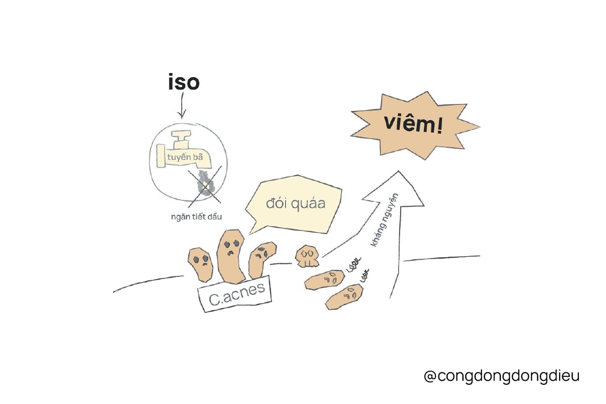 Bùng phát mụn sau isotretinoin và cách hạn chế bùng phát?