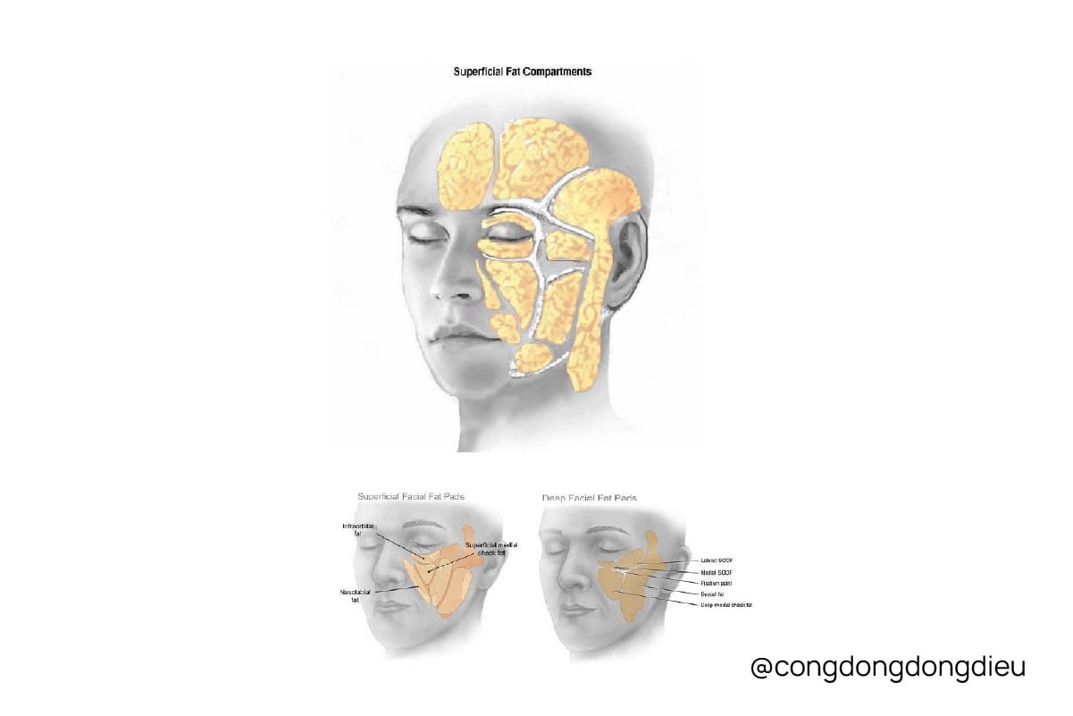 Những vùng tiêm filler có thể gây chảy xệ khuôn mặt