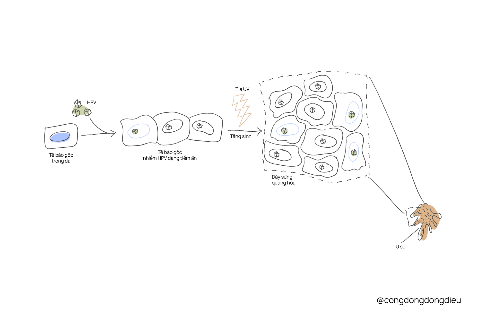 Chứng loạn sản biểu bì mụn cóc (Epidermodysplasia verruciformis - EV)