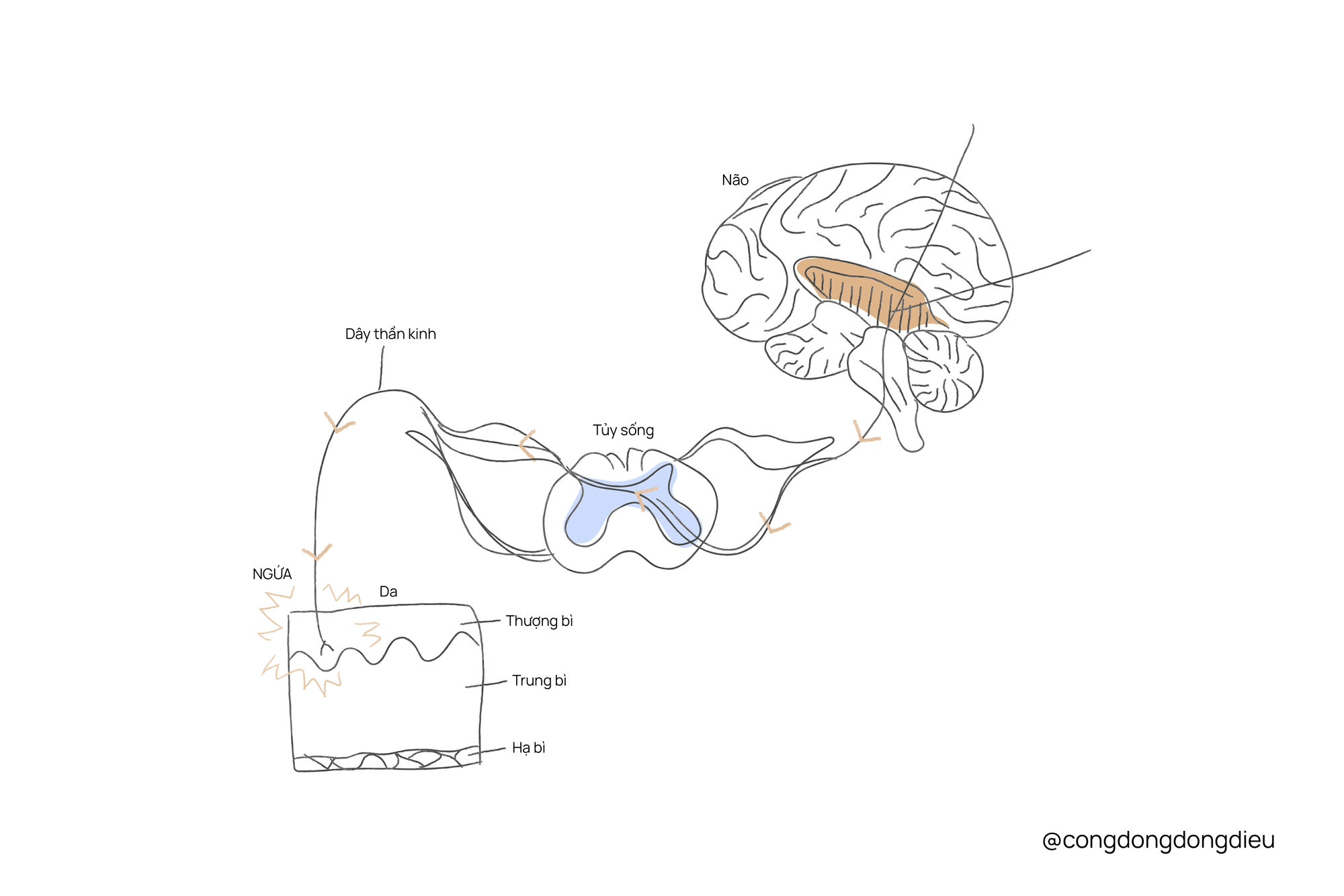 Bệnh Morgellons