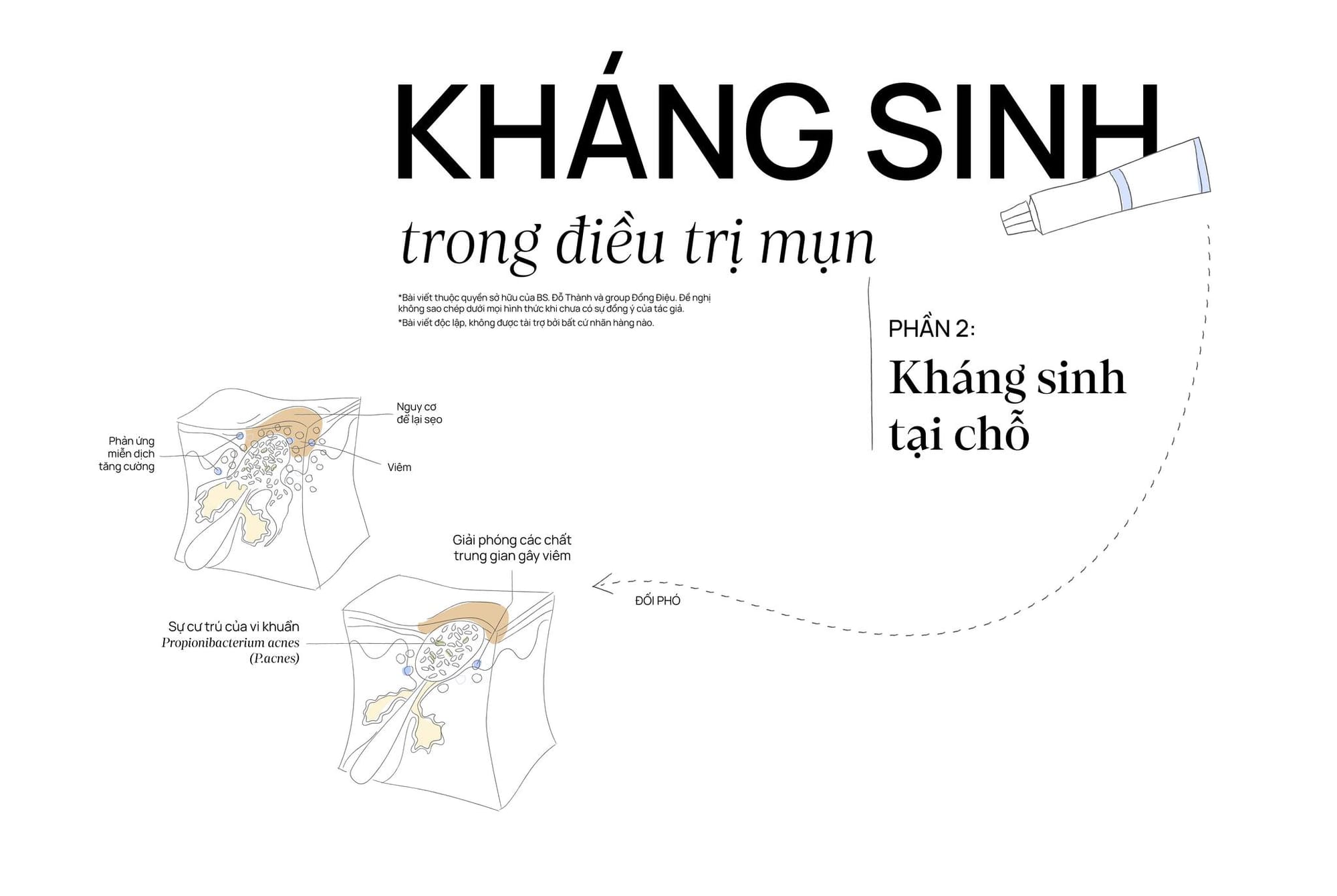 Kháng sinh trong điều trị mụn trứng cá (Phần 2)
