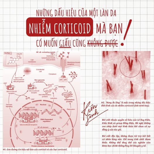 “ĐỌC VỊ” LÀN DA: NHỮNG DẤU HIỆU CỦA MỘT LÀN DA NHIỄM CORTICOID MÀ BẠN CÓ MUỐN GIẤU CŨNG KHÔNG ĐƯỢC