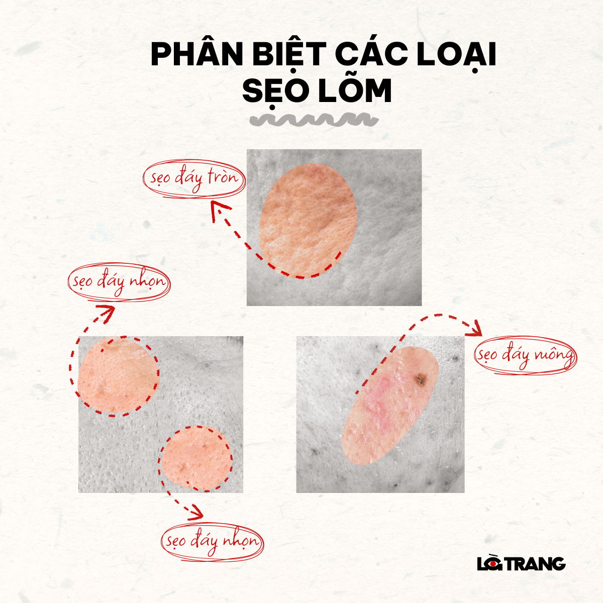 cac-loai-seo-1