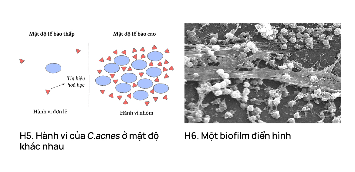 5 hiểu lầm về vi khuẩn gây mụn - dễ khiến càng trị càng nặng?