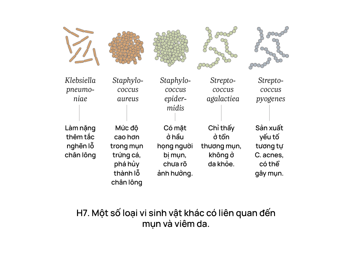 5 hiểu lầm về vi khuẩn gây mụn - dễ khiến càng trị càng nặng?