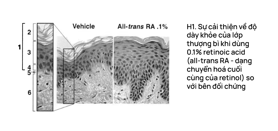 Lý giải dùng retinol mà da trơ trơ không thấy hiệu quả!